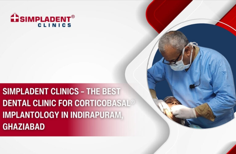 Simpladent Clinics – The Best Dental Clinic for Corticobasal® Implantology in Indirapuram, Ghaziabad