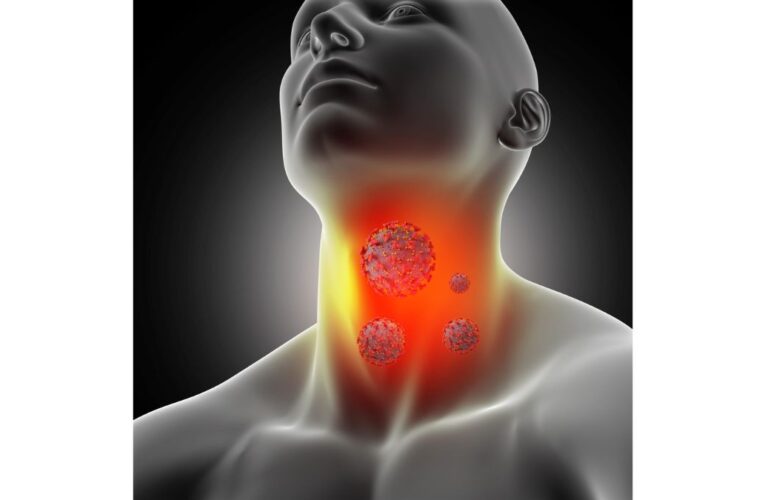 Early Signs and Symptoms of Thyroid Cancer You Should Not Ignore